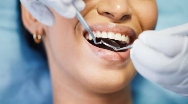 Best Emergency Dentist for Lost Fillings or Crowns in Islandia, NY